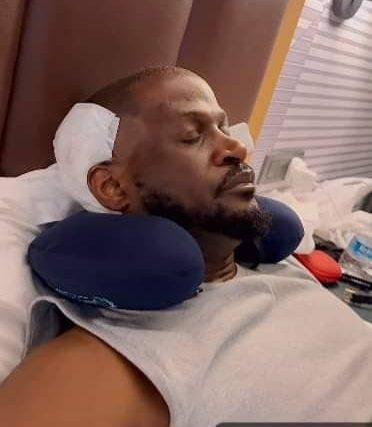 Singer Peter Okoye Undergoes Hair Transplant in Turkey